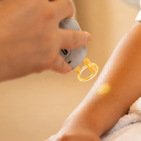 customのイメージ写真。腕の脱毛をしている様子が写っています。